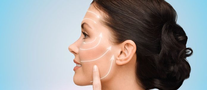 Fili di sospensione - Dr. Urso Chirurgia estetica